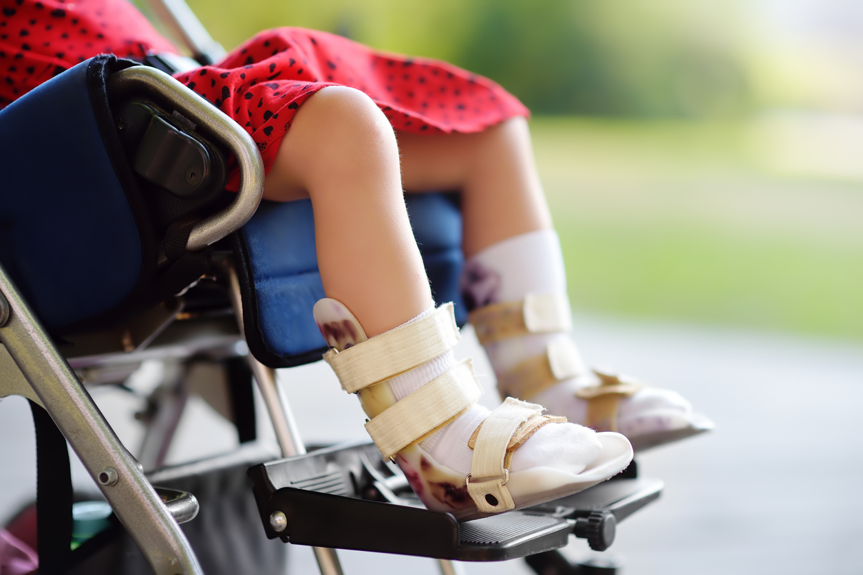 Is cerebral palsy always a birth injury?