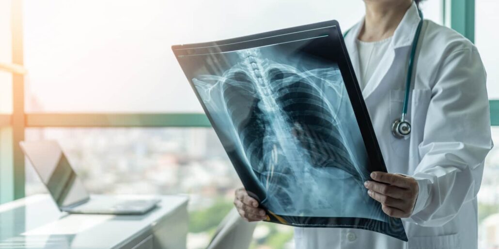doctor examines patient chest x-ray