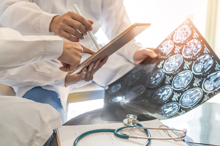 doctors discussing brain scan results - can a car accident cause a stroke?